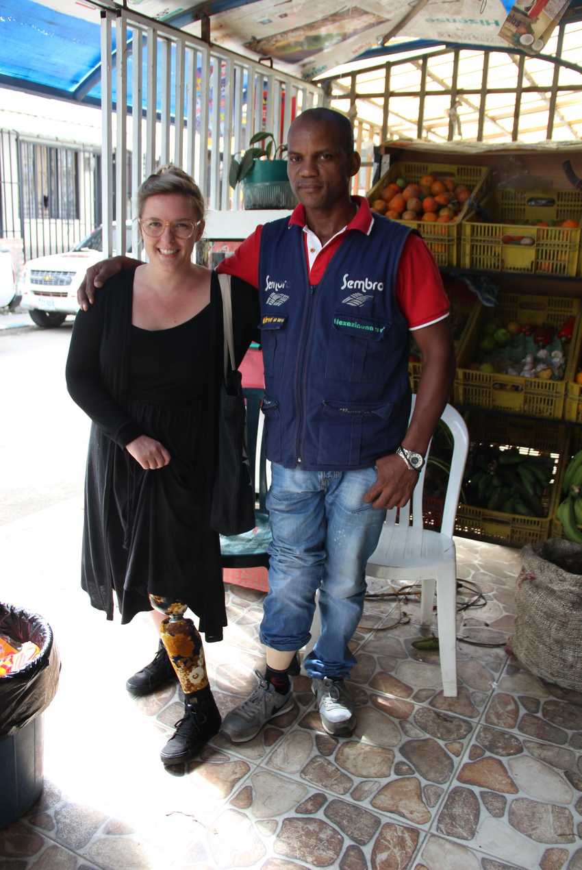 Robbie with a Latin American man, both showing off their prosthetic legs